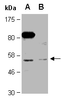 PRMT2 Antibody Western (Abiocode)