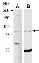 ELL2 Antibody Western (Abiocode)