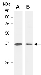 ATF1 Antibody Western (Abiocode)