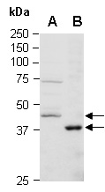 BRCC3 Antibody Western (Abiocode)