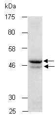LXRA Antibody Western (Abiocode)