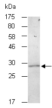 PRSS1 Antibody Western (Abiocode)