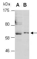 PERFORIN Antibody Western (Abiocode)