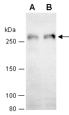 RBBP6 Antibody Western (Abiocode)