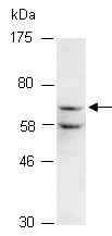 CARM1 Antibody Western (Abiocode)