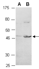 BMP8A Antibody Western (Abiocode)