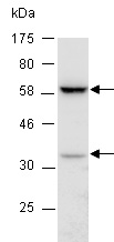 PD1 Antibody Western (Abiocode)