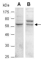 KLRG1 Antibody Western (Abiocode)