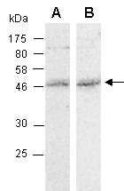 MMS21 Antibody Western (Abiocode)