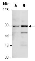 FOXP1 Antibody Western (Abiocode)