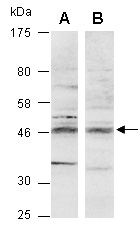 BHLHE40 Antibody Western (Abiocode)