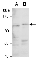 HDAC5 Antibody Western (Abiocode)