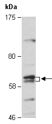 ESR1 Antibody Western (Abiocode)