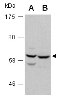 SRC Antibody Western (Abiocode)