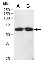 LYVE1 Antibody Western (Abiocode)