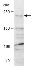 CHD3 Antibody Western (Abiocode)