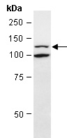 SMARCA5 Antibody Western (Abiocode)