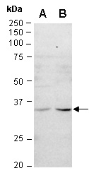 CTLA4 Antibody Western