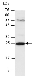 ARHGDIB Antibody Western (Abiocode)