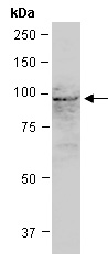AGO1 Antibody Western (Abiocode)