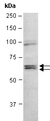 IL21R Antibody Western (Abiocode)