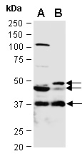 CD20 Antibody Western (Abiocode)