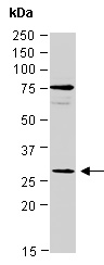 EIF4EBP1 Antibody Western (Abiocode)