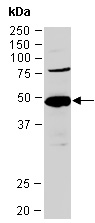 NDRG1 Antibody Western (Abiocode)