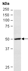 KRT8 Antibody Western (Abiocode)