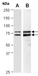 IL13RA2 Antibody Western (Abiocode)