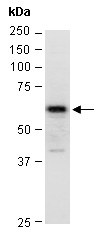 ZFP161 Antibody Western (Abiocode)
