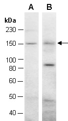 WHSC1 Antibody Western (Abiocode)