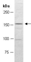 MED14 Antibody Western (Abiocode)