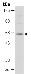 RIPK3 Antibody Western (Abiocode)