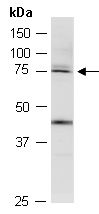 THOC5 Antibody Western (Abiocode)