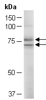 PADI4 Antibody Western (Abiocode)