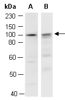 AXIN2 Antibody Western (Abiocode)