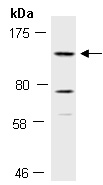 KDM2A Antibody Western (Abiocode)
