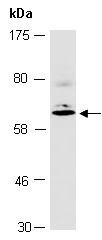 MMP16 Antibody Western (Abiocode)