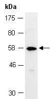 MMP20 Antibody Western (Abiocode)