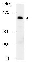 ROBO4 Antibody Western (Abiocode)