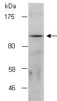 ZEB2 Antibody Western (Abiocode)