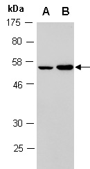 PAX5 Antibody Western (Abiocode)