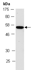 IKZF1 Antibody Western (Abiocode)