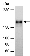 EGFR Antibody Western (Abiocode)