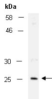 HPRT1 Antibody Western (Abiocode)