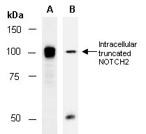 NOTCH2 Antibody Western (Abiocode)