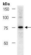 KRT2 Antibody Western (Abiocode)
