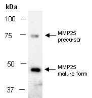 MMP25 Antibody Western (Abiocode)