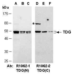 TDG Antibody Western (Abiocode)